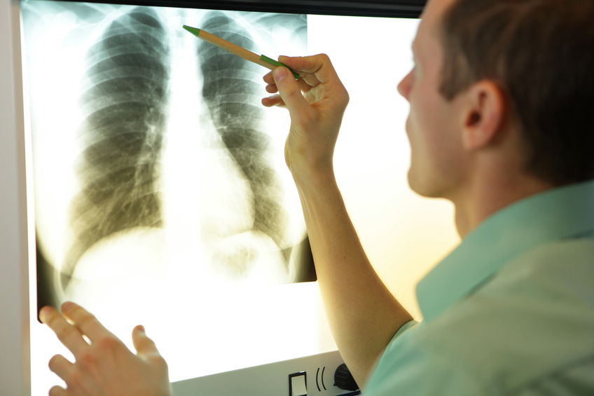 respiratory medicine speciality certificate examination 